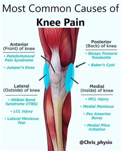 If you have knee pain maybe the photo will help you figure out what may ...