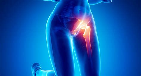 Hip Impingement surgery | Orthopaedics WA