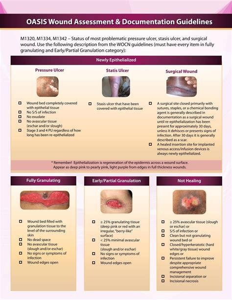 Wound Care Nursing, Home Health Nurse, Pressure Ulcer, Chemical Bond ...