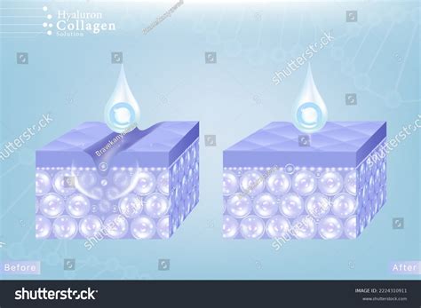 Hyaluronic Acid Before After Hair Skin Stock Vector (Royalty Free) 2224310911 | Shutterstock