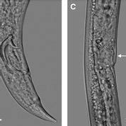 Light microscope observations of Bursaphelenchus xylophilus collected... | Download Scientific ...