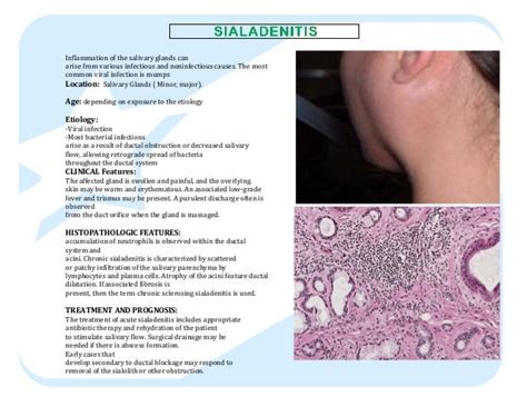 Mucocele in oral cavity