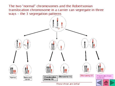 Robertsonian chromosome translocations the basics a tutorial to