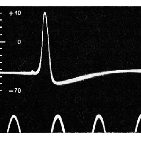 Recording of an intracellular action potential in a giant squid axon ...