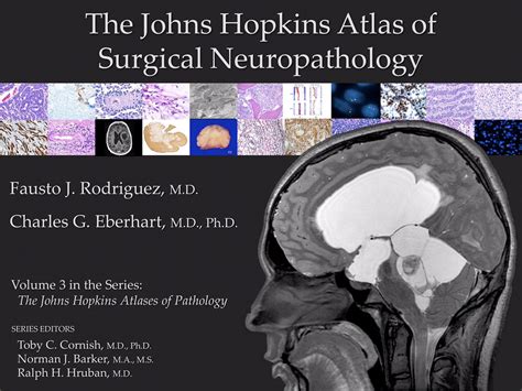 neuropathology blog: Screenshots of the surgical neuropathology volume ...