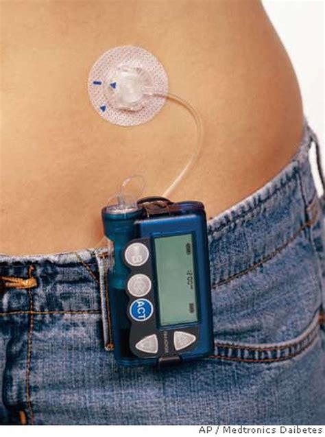 FDA warns that teens using insulin pumps may be too careless