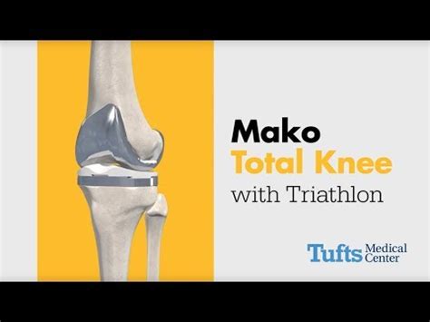 Total Knee Replacement Animation - Tufts Medical Center - Robotics Plus