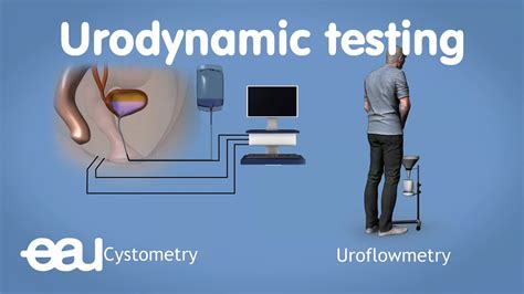 Urodynamic Testing Procedure