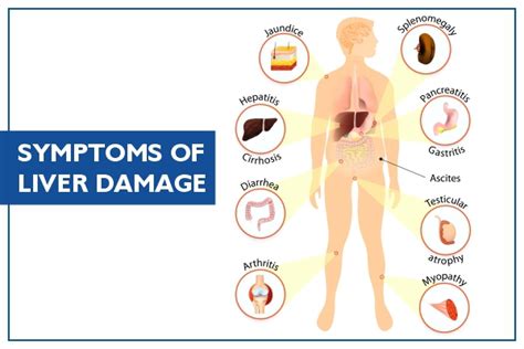 Liver Cancer: Symptoms, Signs, Causes & Treatment