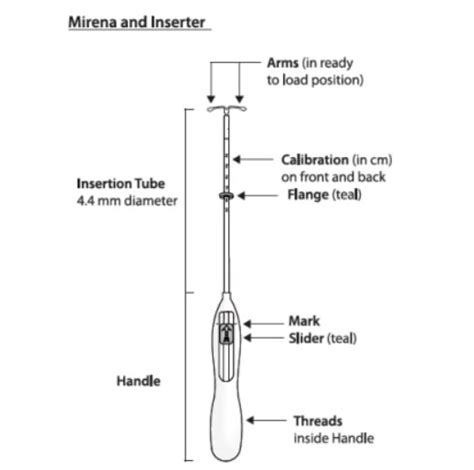 Mirena Removal $890 or by insurance. Mirena Removal or Mirina Insertion