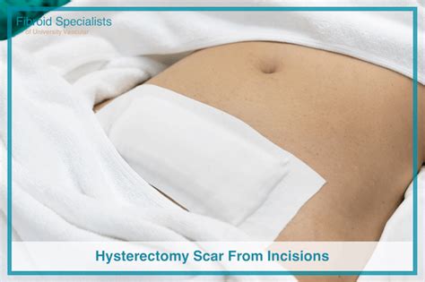 Hysterectomy Scar From Incisions (Pictures) | Fibroid Specialists