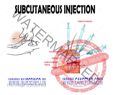 SUBCUTANEOUS INJECTION - Nurse Info