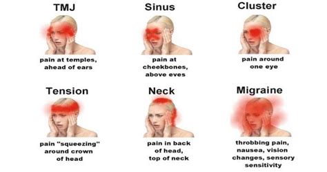 10 Alarming Headache Signs and Symptoms That You Mustn't Ignore