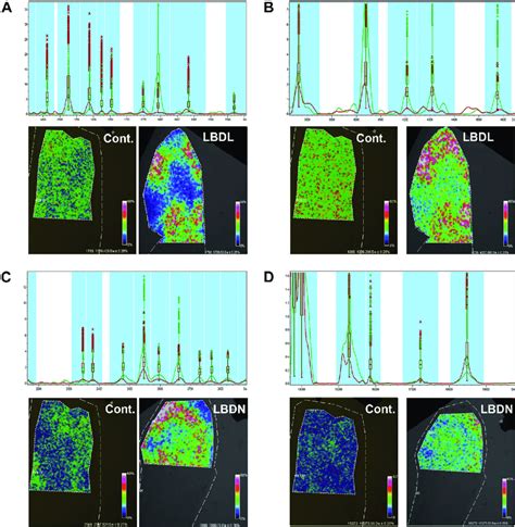 MALDI imaging mass spectrometry of human OB. Mean spectra of the whole ...