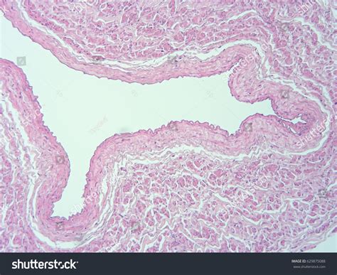 Histology Human Heart Show Cardiac Tissue Stock Photo 629875088 | Shutterstock