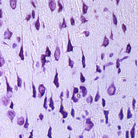 Modeling of Cerebral Anoxia of Respiratory Genesis in Rats | Auctores