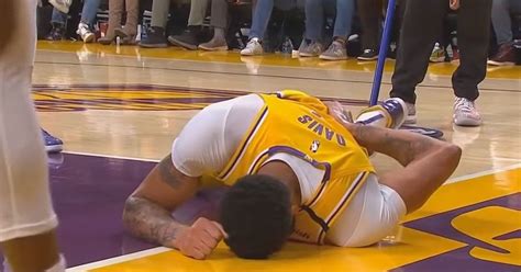 Lakers Anthony Davis Injury updates after Nasty Fall