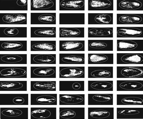 Results of Mammogram images. | Download Scientific Diagram