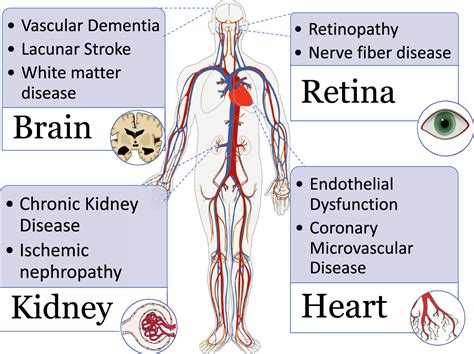 Chronic Ischemic Microvascular Changes