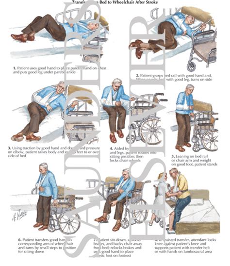 Transfer from Bed to Wheelchair After Stroke