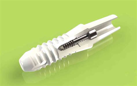 Why is Zirconia a perfect material for dental implants? | Dental AlvarezDental Clinic – Dentists ...