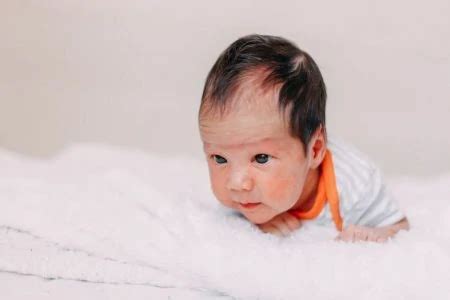 9 Baby Skin Discolorations & Birthmarks: With Pictures