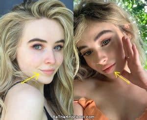 Sabrina Carpenter Plastic Surgery Comparison Photos