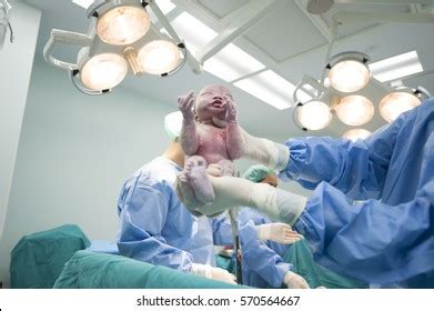 "cesarean Section Images, Stock Photos & Vectors | Shutterstock