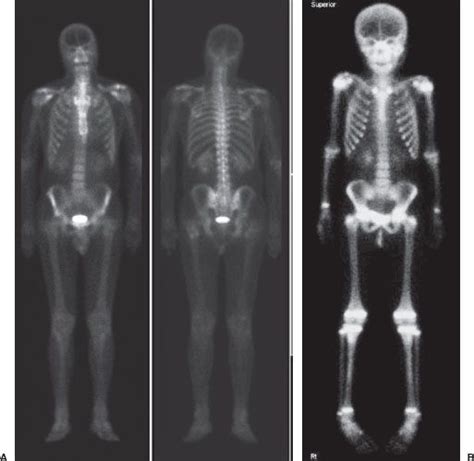 10 Nuclear Imaging | Radiology Key