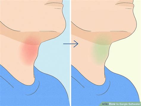 How to Gargle Saltwater for a Sore Throat: Benefits & Tips