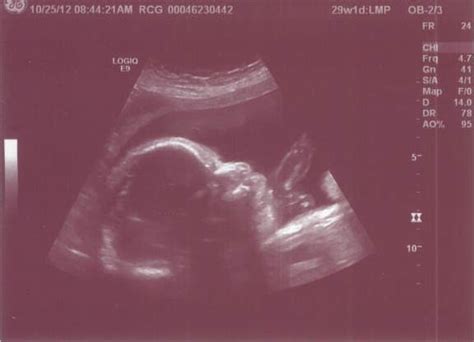 Luke: Lighting Up Our Lives: 29 Week Ultrasound Photos