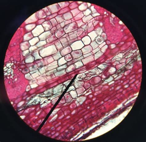 Cambium of the root is the example of(a) Apical meristem(b) Intercalary ...