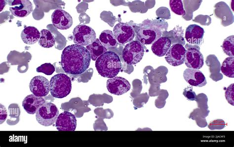 Basophilic Myelocyte