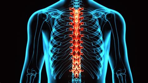 Spinal stroke: Symptoms, causes, recovery, and prognosis