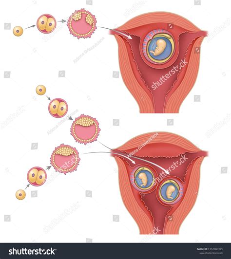 Human Embryo Twins