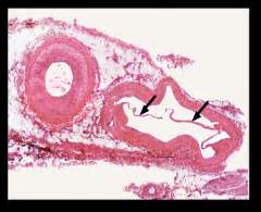 Histology Chapter 11 - Circulatory System Flashcards - Cram.com