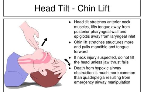 Sthanu on Twitter: "Head Tilt-Chin Lift and Jaw-Thrust Maneuvers Which ...