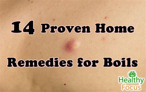 14 Proven Home Remedies for Boils - Healthy Focus