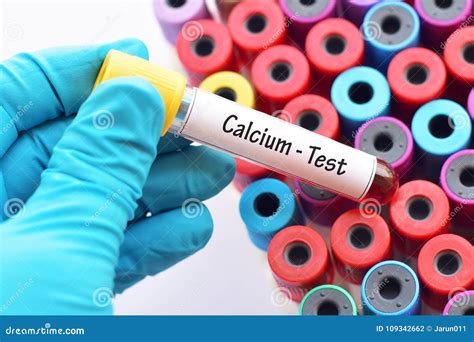 Calcium test stock photo. Image of calcium, chemical - 109342662