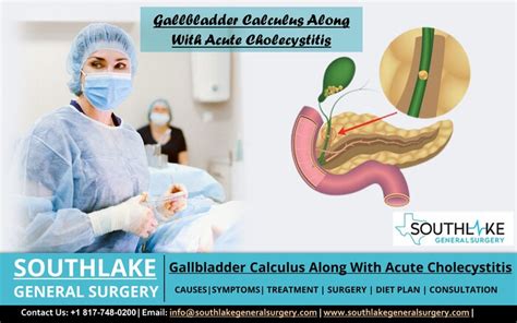 Gallbladder Calculus Plus Acute Cholecystitis - Southlake General Surgery