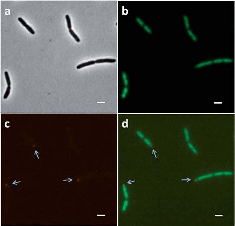 Fluorescence microscopy photos of E. coli MG1665 cells at their mid-log ...