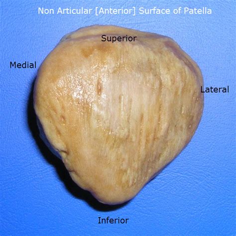 Anatomy of Patella | Bone and Spine