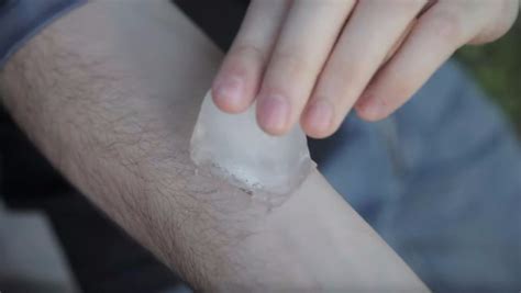 Warnings over 'salt and ice challenge' internet craze | ITV News