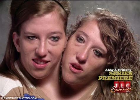 Abby and brittany hensel conjoined twins engaged - gaseplus