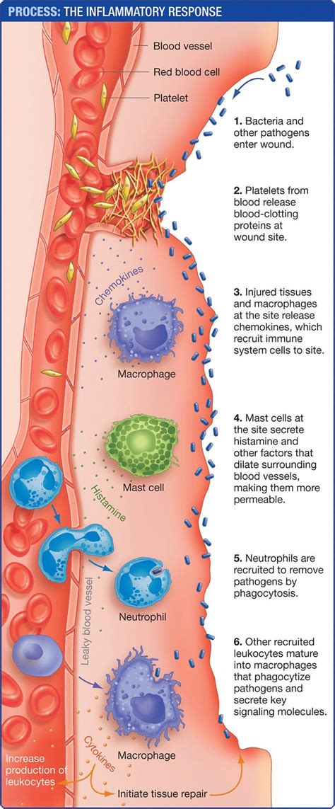 Inflammatory response #PainNaturalRemedies in 2020 | Medical laboratory science, Medical ...