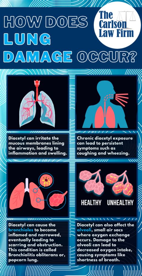 Unsure if Your Can Sue? Know the Signs Popcorn Lung Diagnosis