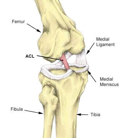 ACL Sprain - SportsRehab.App