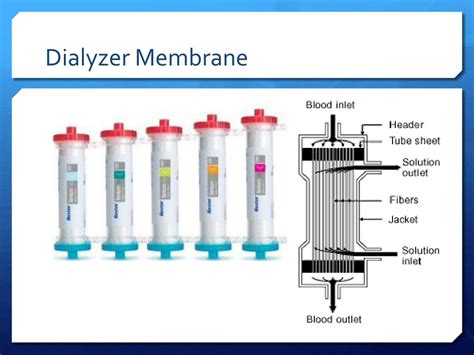 PPT - Renal Failure and Complications of Hemodialysis PowerPoint Presentation - ID:2241657