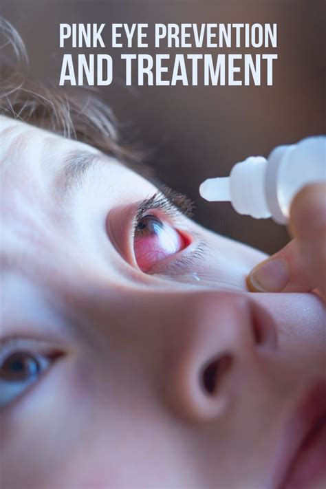 Pink Eye Prevention and Treatment — Thrifty Mommas Tips