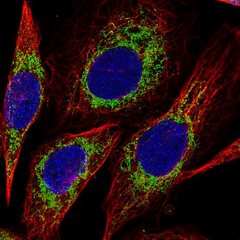 Mouse Monoclonal Anti-CS Antibody - Buy for research - Highly specific, rigorously validated and ...